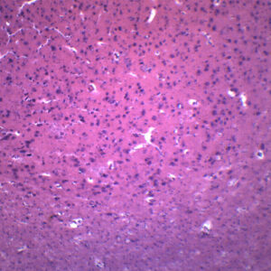 Brain Section - Prepared Microscope Slide - 75x25mm