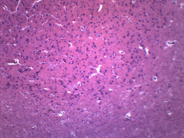 Brain Section - Prepared Microscope Slide - 75x25mm