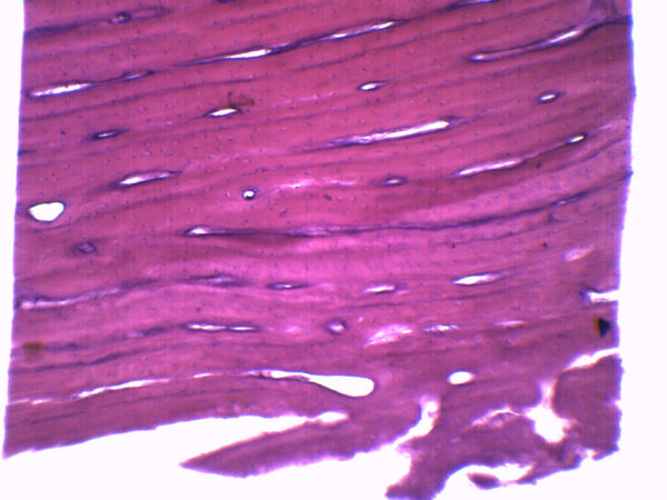 Bone - Cross Section & Longitudinal Section - Prepared Microscope Slide - 75x25mm
