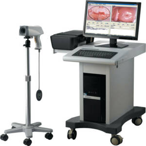 DIGITAL COLPOSCOPE IMAGING SYSTEM POY-2200