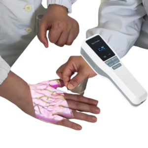 Medical vain finder