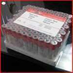 Cryo tubes , cryovials or cryogenic tubes