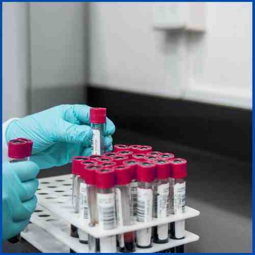 lab test near me, lab tests, medical lab near me, diagnostic center, analysis helpdesk. Good Laboratory Practice Guidelines