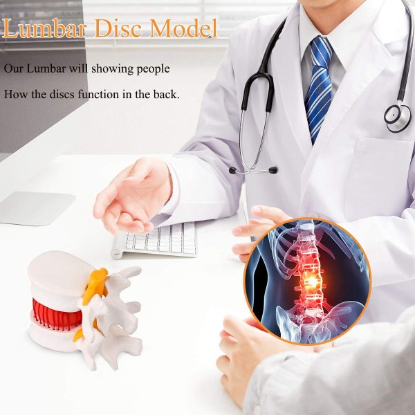 Human Anatomical Lumbar Disc Herniation Model - Lumbar Spine Model for Teaching & Learning - Excellent Way for Demonstrating Disc - Image 6