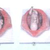 Development Process of Foetus