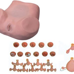 Gynecological Examination Model AR-7 ARI