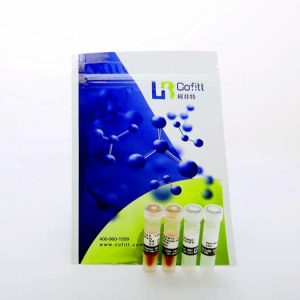 Wholesale High Quality High Speed-strand Chemical Reagents cDNA Synthesis Plus Kit