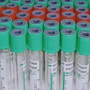 Factory Wholesale 5ml PET  Whole Blood Or Plasma Vacuum Blood Collection Tube supplier