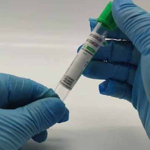 Factory Price Pet Disposable 5ml Lithium Heparin Vacuum Blood Collection Tube