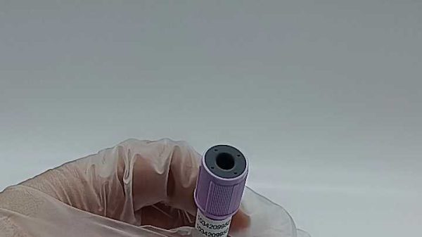 custom wholesale EDTA vacuum blood collection tube purple top vacutainer vacuum tube phlebotomy