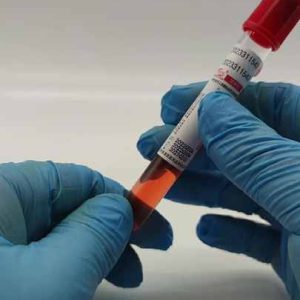 Medical Consumable Supplies Item Plain Vacuum Blood Collection Tube