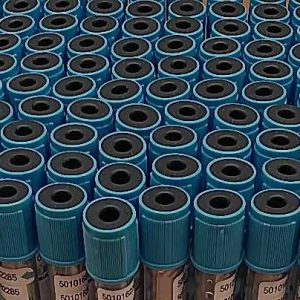 Custom Wholesaler 2ml PET Vacuum blood collection vacutainer tube Supplier
