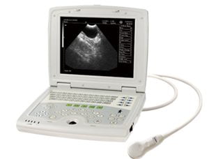 MON509 Full Digital B Mode Ultrasonic Diagnostic Instrument KX5000