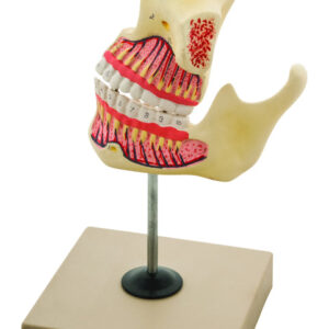 Model Upper & Lower Jaw - 3 times enlarged