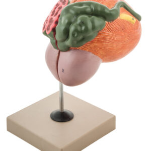 Eisco Labs Human Urinary Bladder with Prostate Anatomical Model, 2 Parts, 3 Times Life Size, Approx. 8"x8"x6"