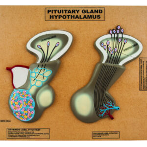 Eisco Labs Model of Pituitary Gland and Hypothalamus; Greatly Enlarged: