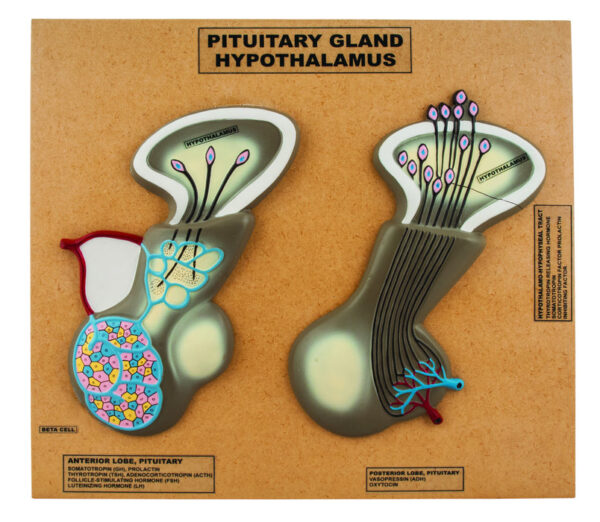 Eisco Labs Model of Pituitary Gland and Hypothalamus; Greatly Enlarged: