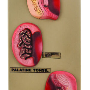 Model Tonsils