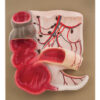 Expansion Model of the Caecum and Vermiform Appendix