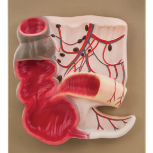 Expansion Model of the Caecum and Vermiform Appendix