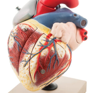 Human Heart Enlarged - 7 Parts