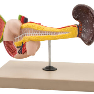 Spleen Pathology