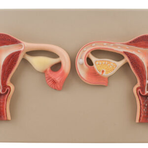 Fertilization Set of 2