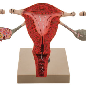 Tubectomy