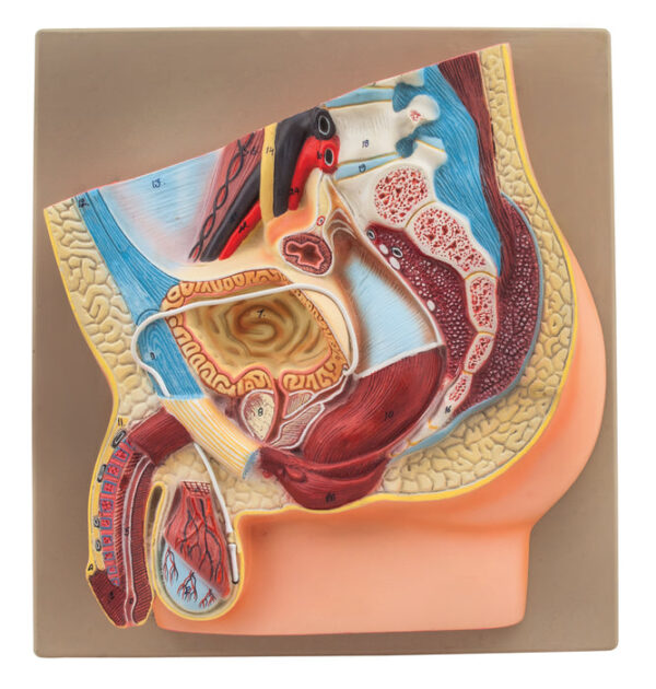 Male Vasectomy