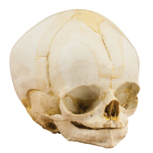 Fetal Skull 29 Weeks
