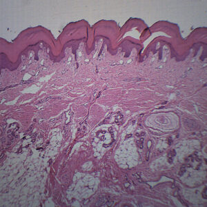 Human Skin - Prepared Microscope Slide - 75x25mm