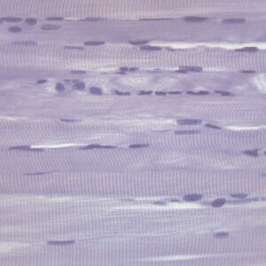 Human Skeletal Muscle (LS) - Prepared Microscope Slide - 75x25mm