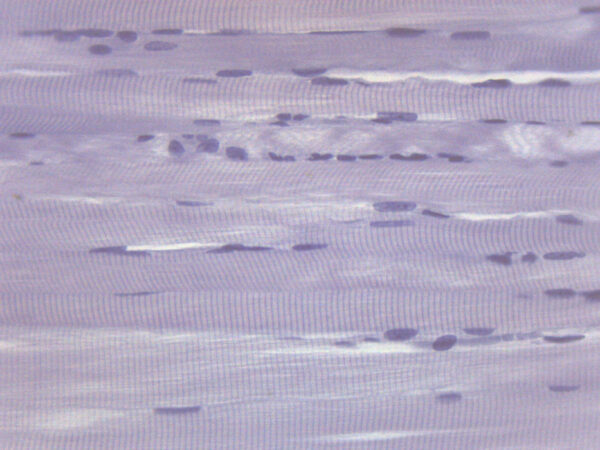Human Skeletal Muscle (LS) - Prepared Microscope Slide - 75x25mm