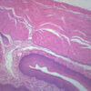 Esophagus Epithelium - Prepared Microscope Slide - 75x25mm