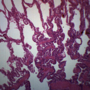 Frog Lung Section - Prepared Microscope Slide - 75x25mm