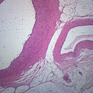 Human Artery, Vein & Nerve - Cross Section - Prepared Microscope Slide - 75x25mm