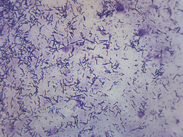 Escherichia Coli Smear - Prepared Microscope Slide - 75x25mm