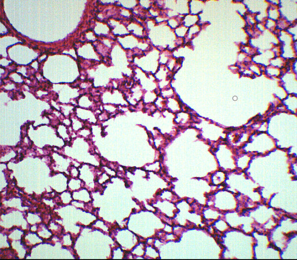 Lung Section - Prepared Microscope Slide - 75x25mm