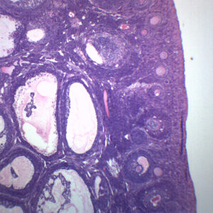 Female Ovary - Prepared Microscope Slide - 75x25mm