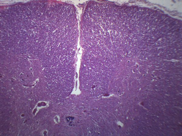 Cervical Spinal Cord, Human - Cross Section - Prepared Microscope Slide - 75x25mm
