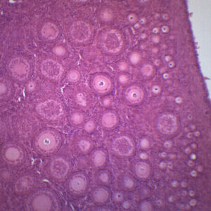 Immature Ovary - Prepared Microscope Slide - 75x25mm