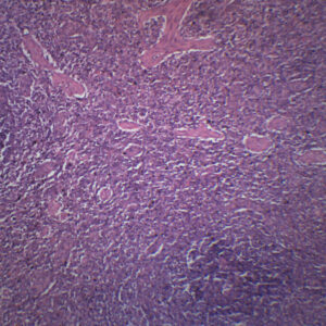Human Spleen Section - Prepared Microscope Slide - 75x25mm