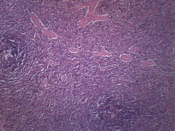 Human Spleen Section - Prepared Microscope Slide - 75x25mm