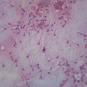Human Sperm Smear - Prepared Microscope Slide - 75x25mm