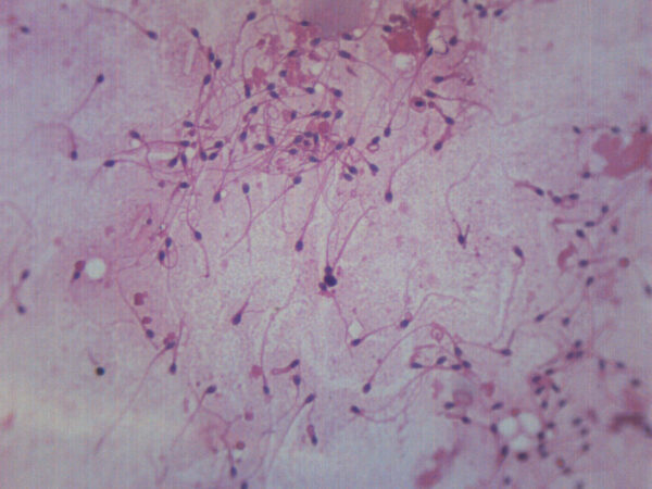 Human Sperm Smear - Prepared Microscope Slide - 75x25mm