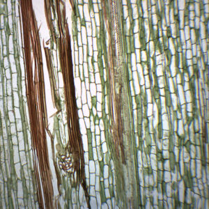 Iris Stem - Cross Section & Longitudinal Section - Prepared Microscope Slide - 75x25mm