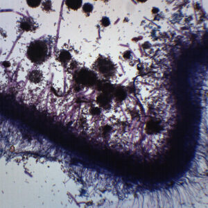 Aspergillus (Brown Mold) - Prepared Microscope Slide - 75x25mm
