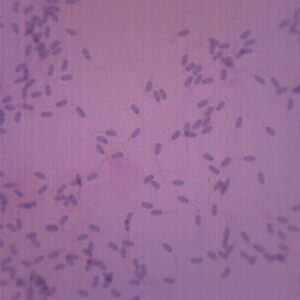Sperm Smear - Prepared Microscope Slide - 75x25mm