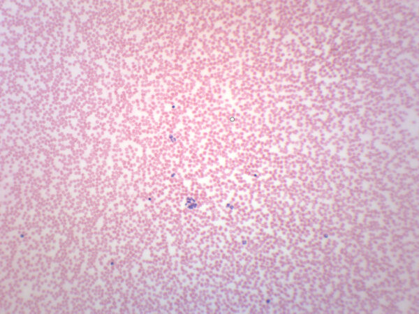 Human Blood Smear (HE Stain) - Prepared Microscope Slide - 75x25mm