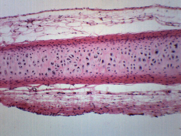 Frog Cartilage Section - Prepared Microscope Slide - 75x25mm